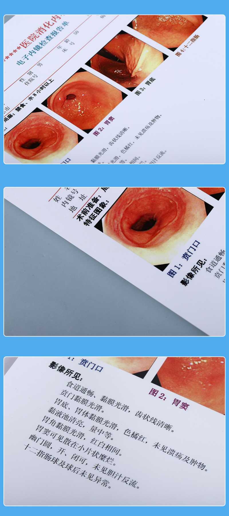 Professional China Supplier of Elderly Rehabilitation and Personal Care Products Professional China Supplier of Elderly Rehabilitation and Personal Care Products