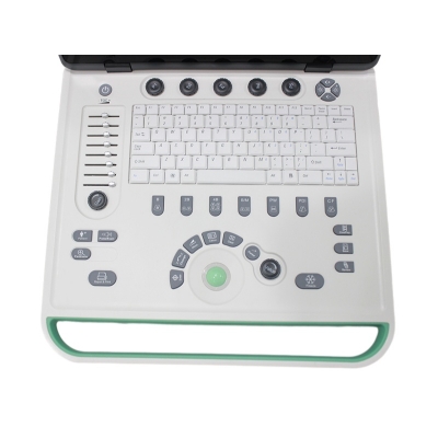 Portable Laptop Color Doppler Ultrasound Medical 3D Doppler
