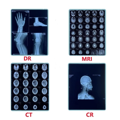 Medical Blue Sensitive X-ray Dry Film Thermal Film with Multiple Sizes