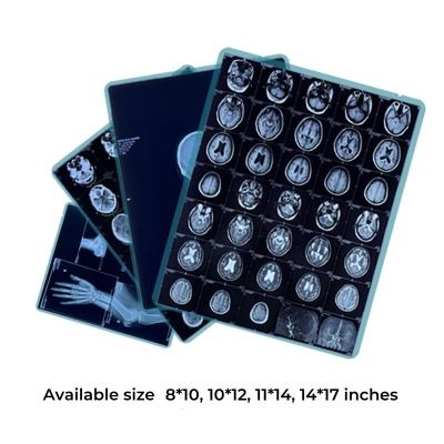 Medical Blue Sensitive X-ray Dry Film Thermal Film with Multiple Sizes