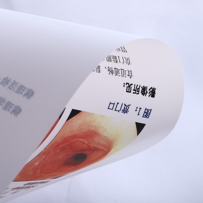 A4 White Color Dry Film Medical Inkjet Pet Laser Film for Ultrasound