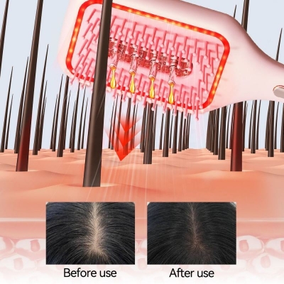 Air Cushion Scalp Massage Comb with Vibration - Hair Serum Dispenser & Oil Applicator Brush