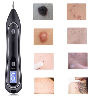 Cosmetic Plasma Spot Removal Pen – Freckle & Skin Blemish Device