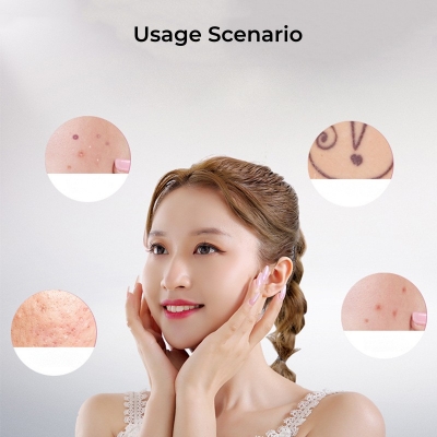 Mole & Skin Tag Removal Plasma Pen for Home Use