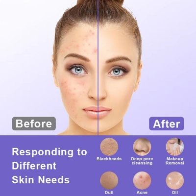 Gentle Silicone Facial Cleaning Brush - Soft Electric Face Cleanser