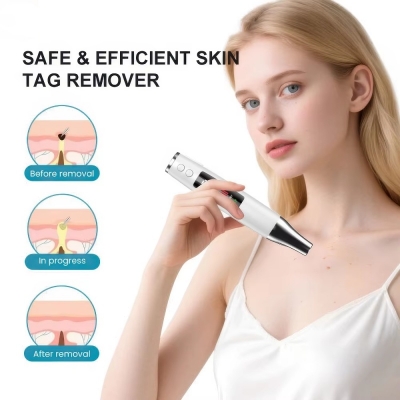 Micro Plasma Beauty Pen for Mole & Skin Tag Removal at Home
