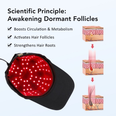Red Light Hair Growth Cap – Cordless Scalp Care Device for Hair Regrowth