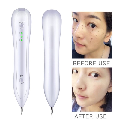 Cheap Price Mole Removal Pen – Skin Tag Remover, Dark Spot Corrector & Eyelid Lifting Beauty Tool for Home Use
